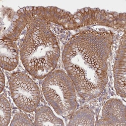 HDC Antibody, Novus Biologicals:Antibodies:Primary Antibodies